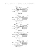 TISSUE CAPTURING AND SUTURING DEVICE AND METHOD diagram and image