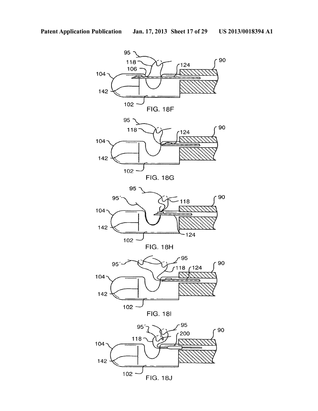 TISSUE CAPTURING AND SUTURING DEVICE AND METHOD - diagram, schematic, and image 18