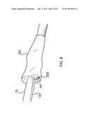 SURGICAL IMPLANT DEPLOYMENT DEVICE diagram and image