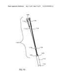 SURGICAL IMPLANT DEPLOYMENT DEVICE diagram and image