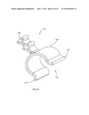 SURGICAL IMPLANT DEPLOYMENT DEVICE diagram and image