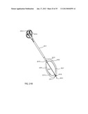 SURGICAL IMPLANT DEPLOYMENT DEVICE diagram and image