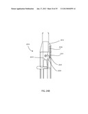 SURGICAL IMPLANT DEPLOYMENT DEVICE diagram and image