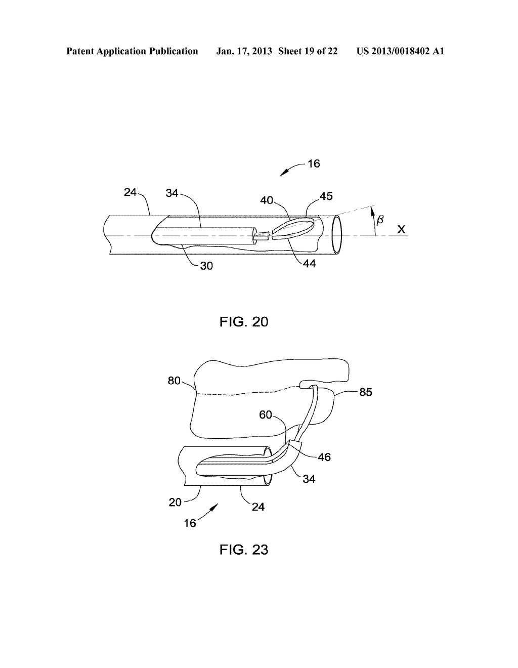 TISSUE SEVERING DEVICES AND METHODS - diagram, schematic, and image 20