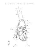 MEDICAL CUTTING INSTRUMENT FOR CUTTING MUSCLES AND TENDONSAANM Berberich; SaschaAACI TuttlingenAACO DEAAGP Berberich; Sascha Tuttlingen DE diagram and image