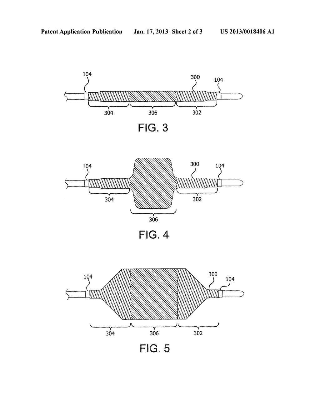 EXPANDABLE MEDICAL DEVICESAANM Campbell; Carey V.AACI FlagstaffAAST AZAACO USAAGP Campbell; Carey V. Flagstaff AZ USAANM Hartman; Cody L.AACI FlagstaffAAST AZAACO USAAGP Hartman; Cody L. Flagstaff AZ US - diagram, schematic, and image 03