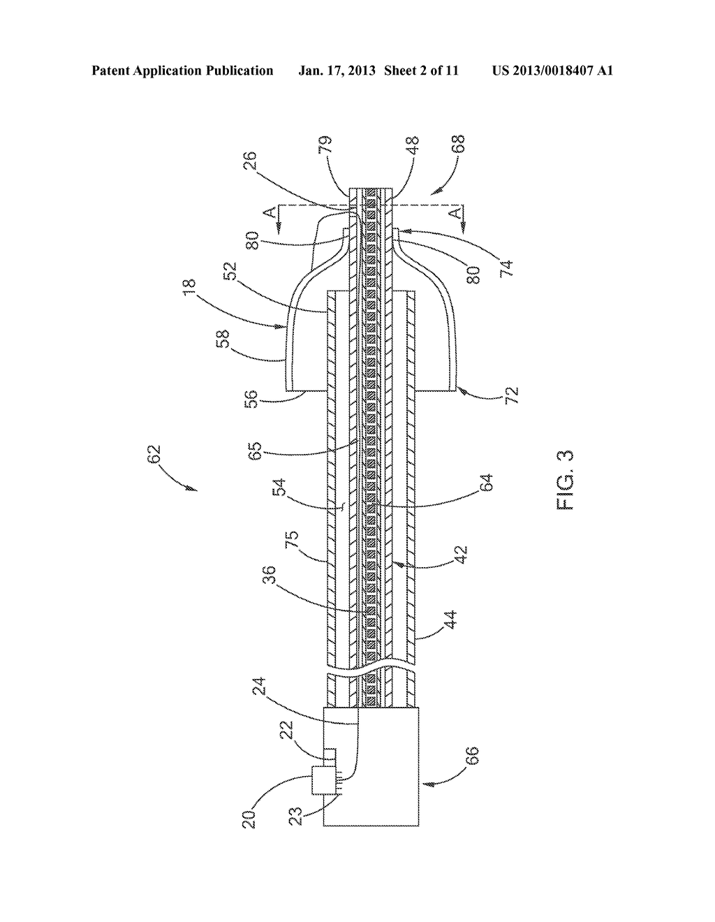 VASCULAR OCCLUSION DEVICE WITH ENHANCED FEEDBACK - diagram, schematic, and image 03