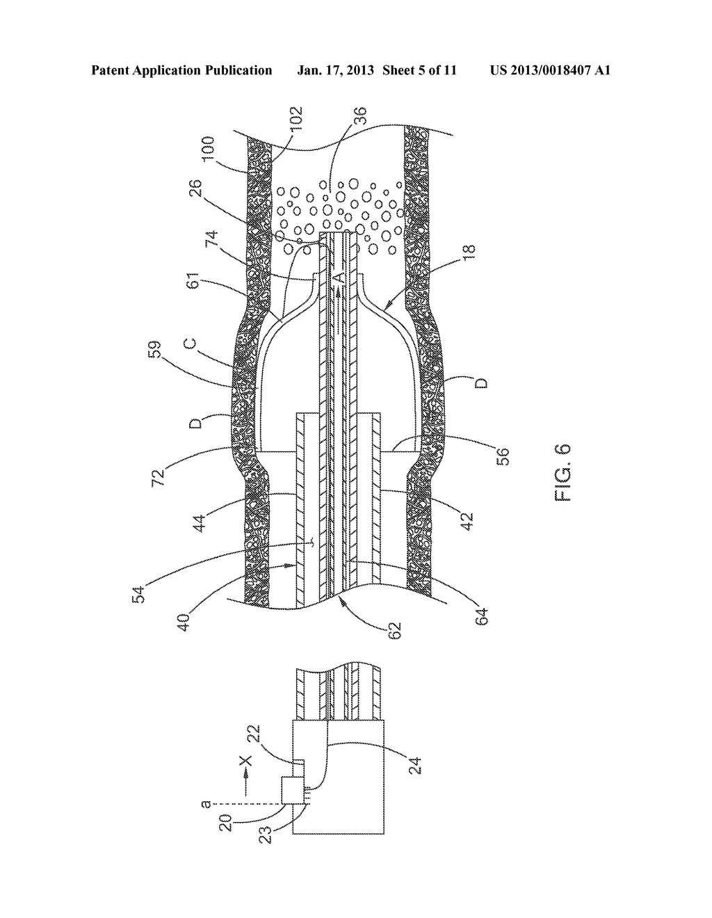 VASCULAR OCCLUSION DEVICE WITH ENHANCED FEEDBACK - diagram, schematic, and image 06