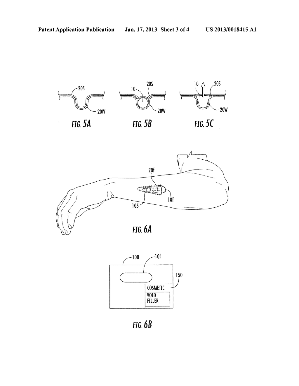 SYNTHETIC COLLAGEN THREADS FOR COSMETIC USES INCLUDING SKIN WRINKLE     TREATMENTS AND ASSOCIATED METHODS - diagram, schematic, and image 04