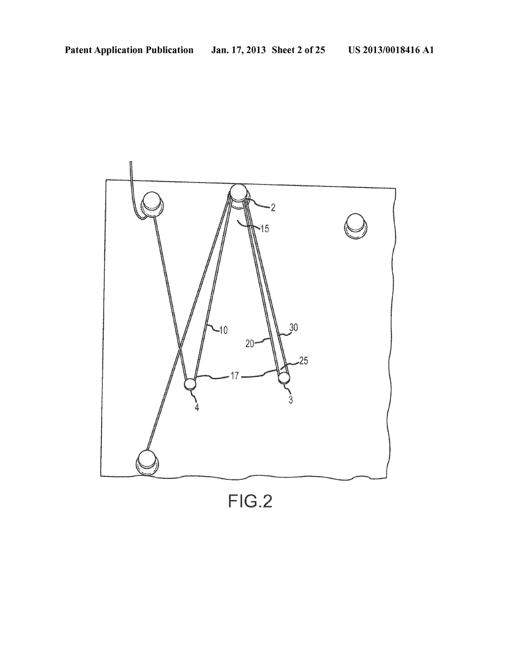 SOFT SUTURE ANCHOR MADE OF BRAIDED OR MONOFILAMENT SUTURE - diagram, schematic, and image 03