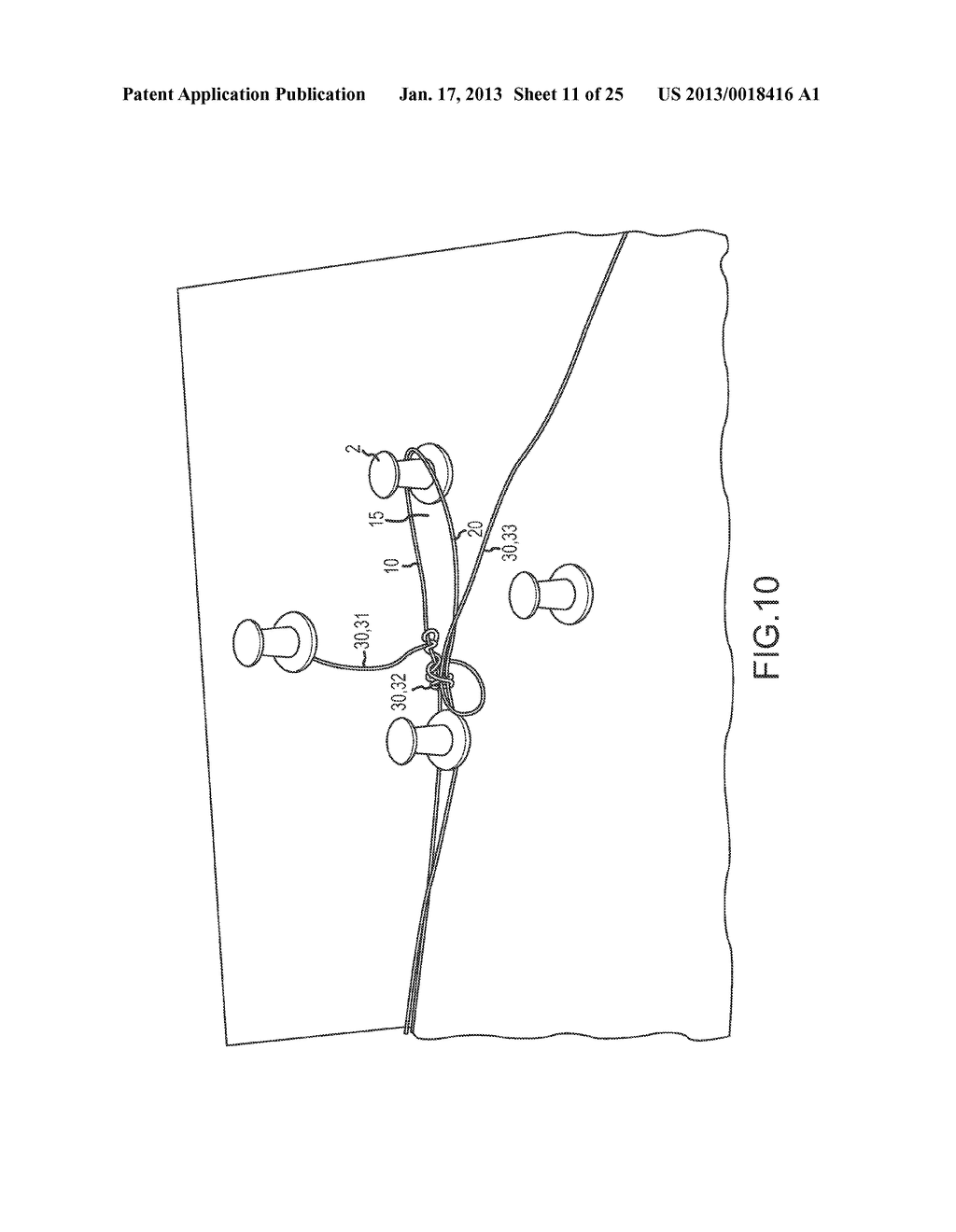 SOFT SUTURE ANCHOR MADE OF BRAIDED OR MONOFILAMENT SUTURE - diagram, schematic, and image 12