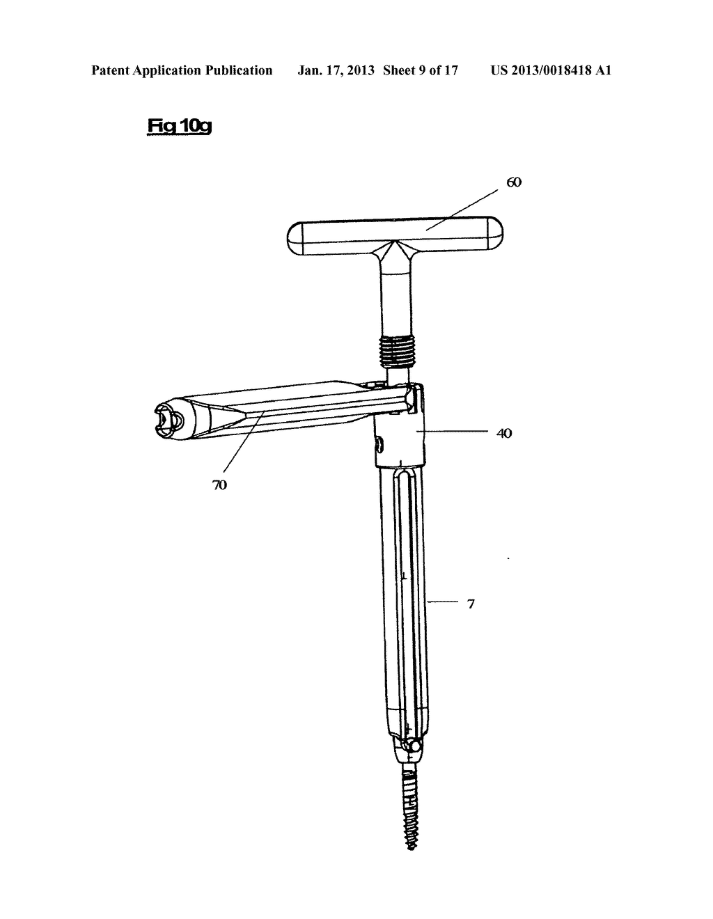 DEVICE AND METHOD FOR SPINAL SURGERY - diagram, schematic, and image 10