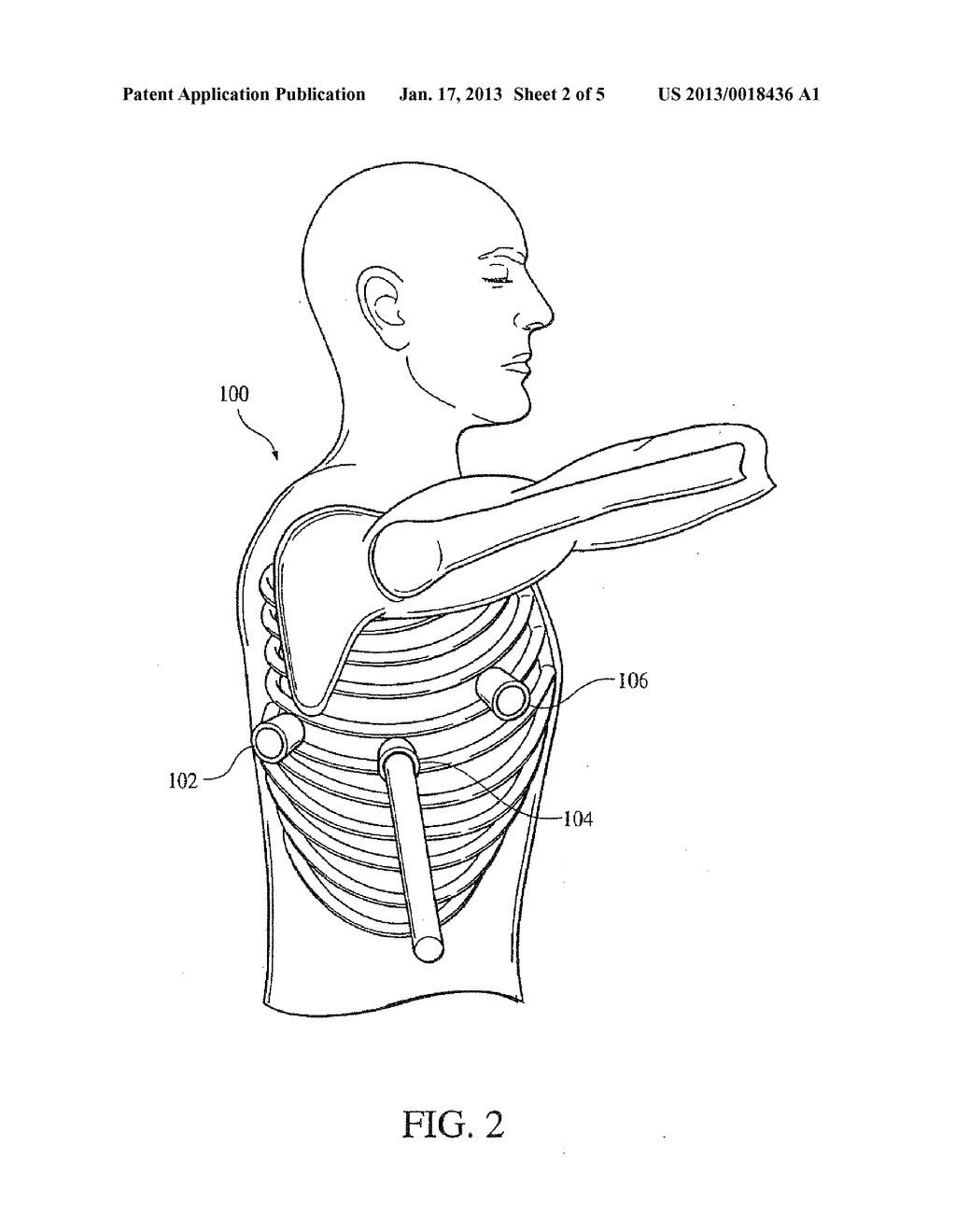 ELECTRICAL STIMULATION OF THE SYMPATHETIC NERVE CHAIN - diagram, schematic, and image 03