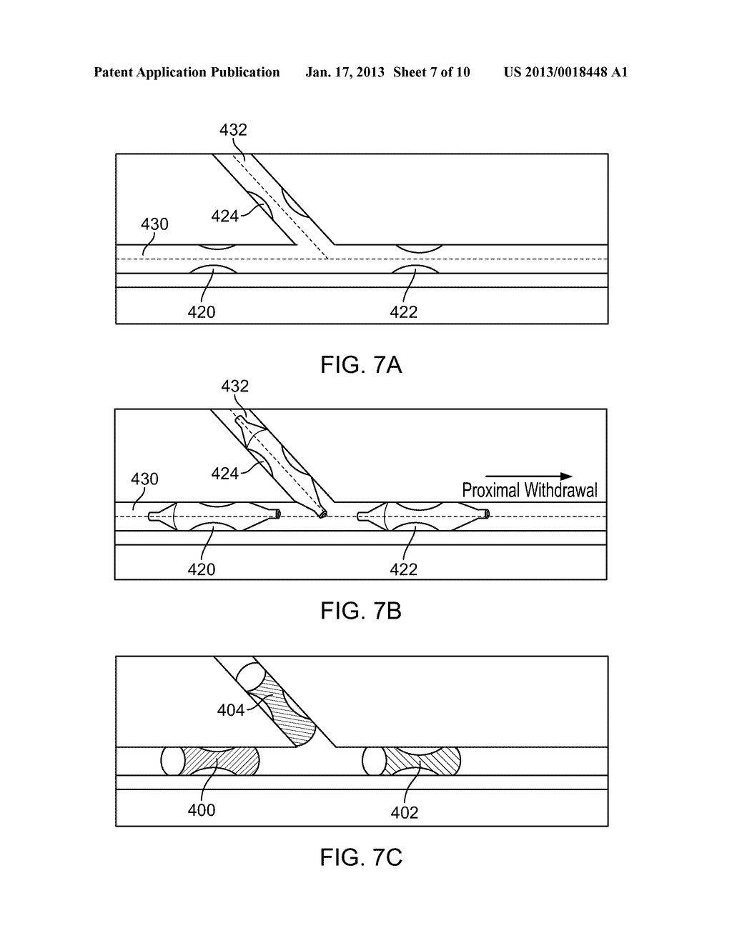 DRUG ELUTION MEDICAL DEVICE - diagram, schematic, and image 08