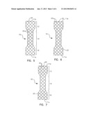 Anti-Migration Stent with Quill Filaments diagram and image