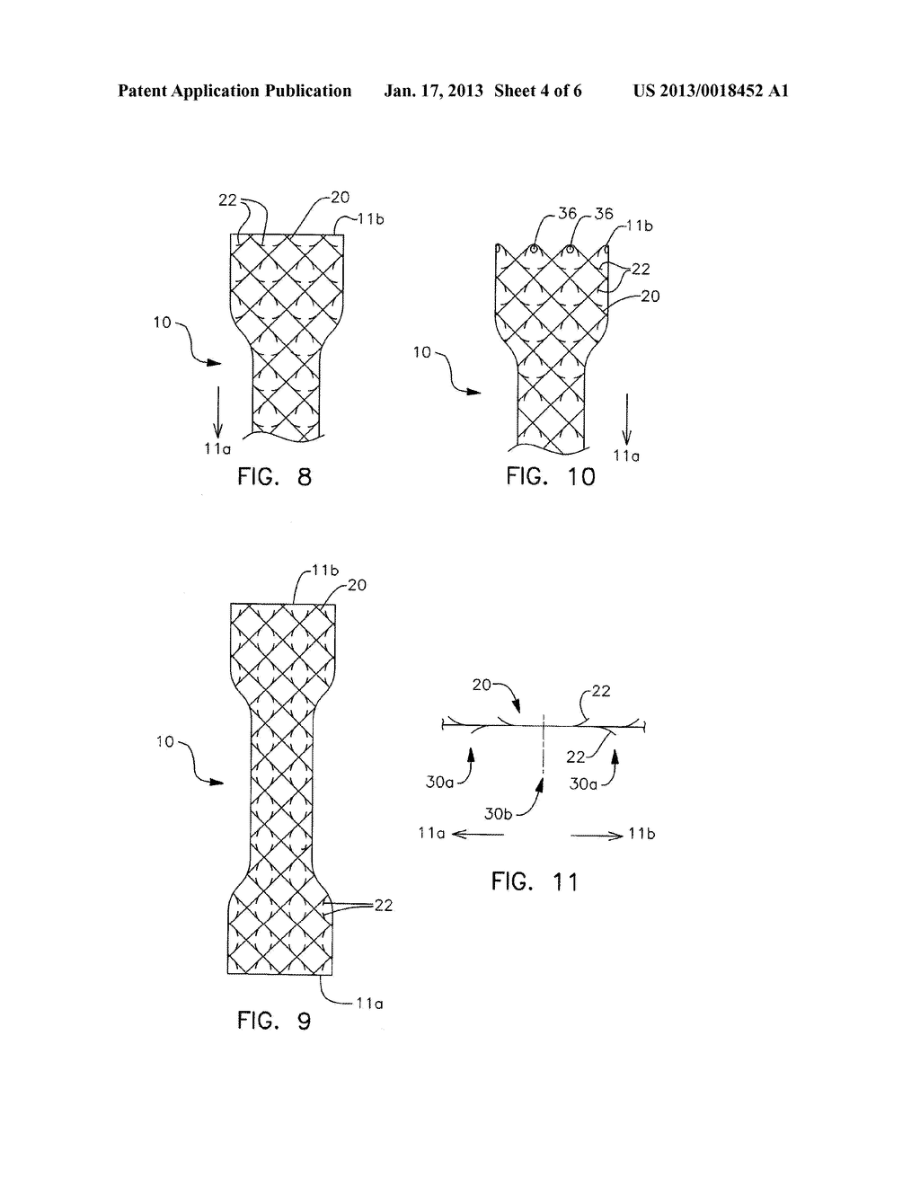 Anti-Migration Stent with Quill Filaments - diagram, schematic, and image 05