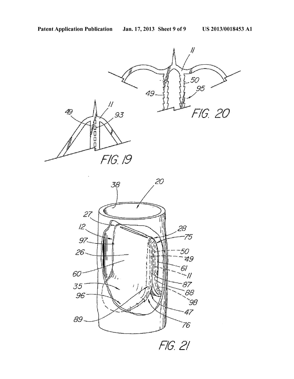 ARTIFICIAL VALVE PROSTHESIS WITH IMPROVED FLOW DYNAMICS - diagram, schematic, and image 10