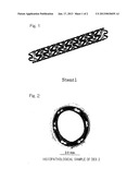 METHOD OF INHIBITING VASCULAR INTIMAL HYPERPLASIA USING STENT diagram and image