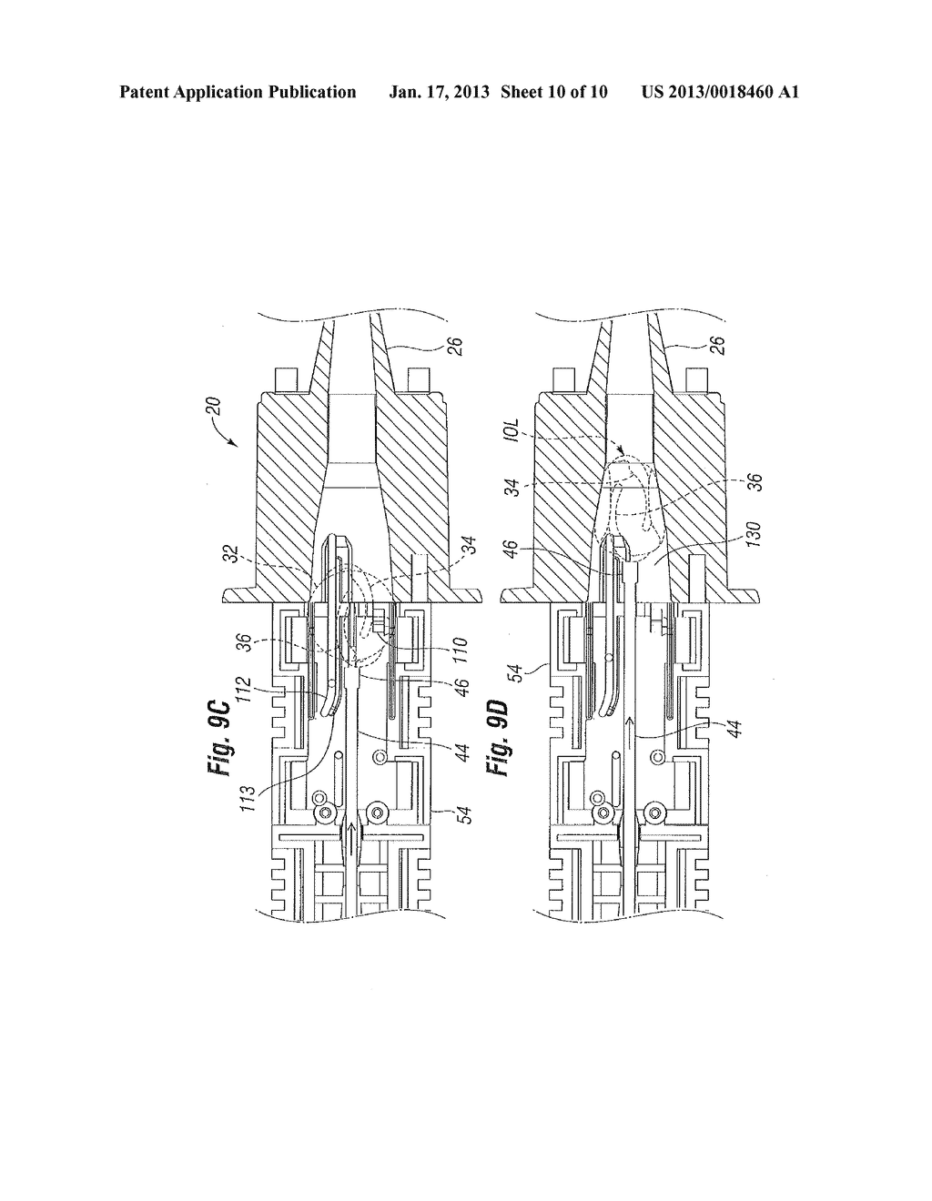 PRE-LOADED IOL INSERTION SYSTEM - diagram, schematic, and image 11