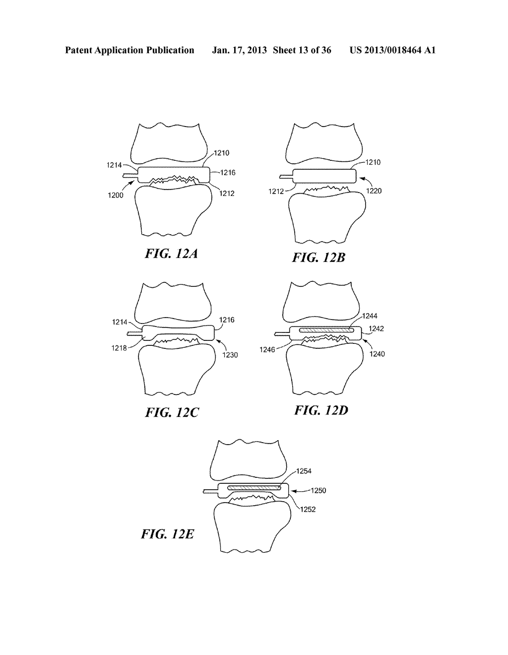 JOINT ARTHROPLASTY DEVICES AND SURGICAL TOOLS - diagram, schematic, and image 14