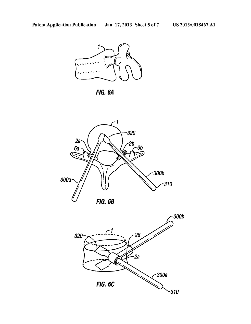 Systems and Methods For Vertebral Body and Disc Height RestorationAANM Suh; SeanAACI BensalemAAST PAAACO USAAGP Suh; Sean Bensalem PA US - diagram, schematic, and image 06