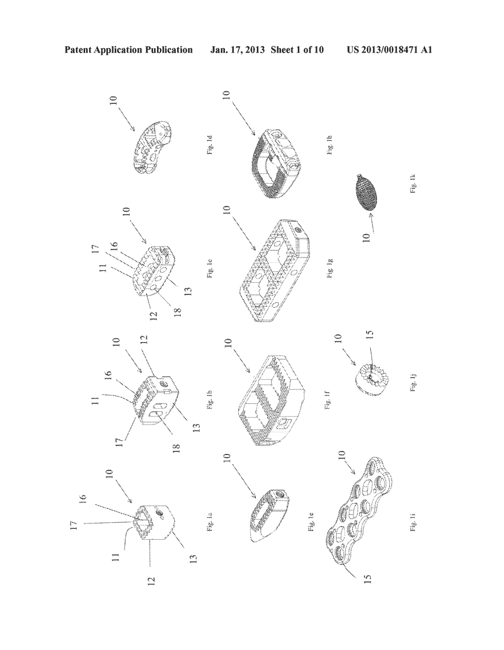 SPINAL IMPLANTS WITH STEM CELLS - diagram, schematic, and image 02