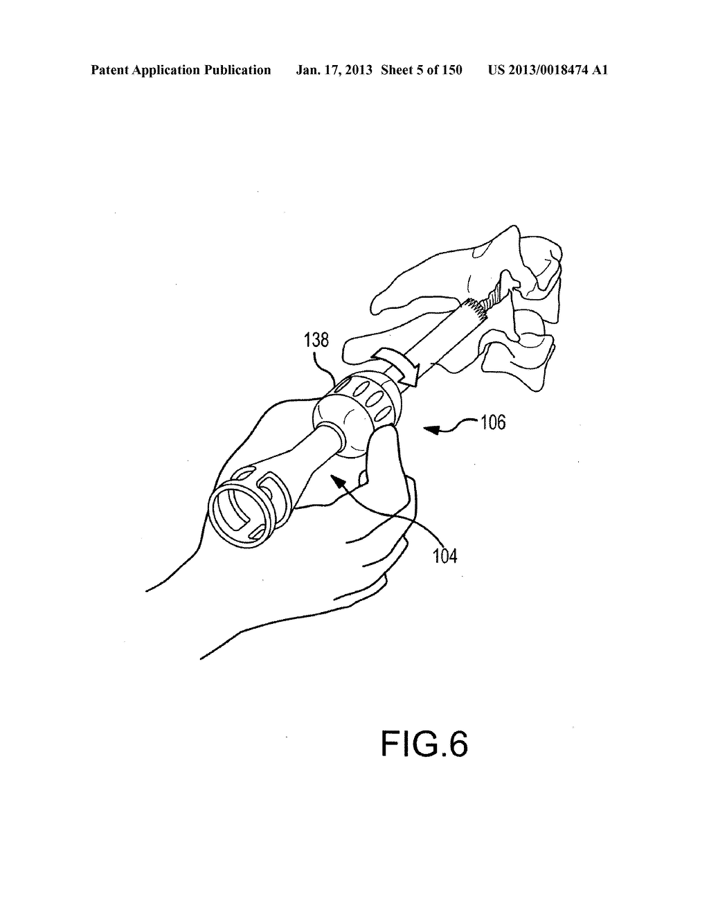 VERTEBRAL JOINT IMPLANTS AND DELIVERY TOOLS - diagram, schematic, and image 06