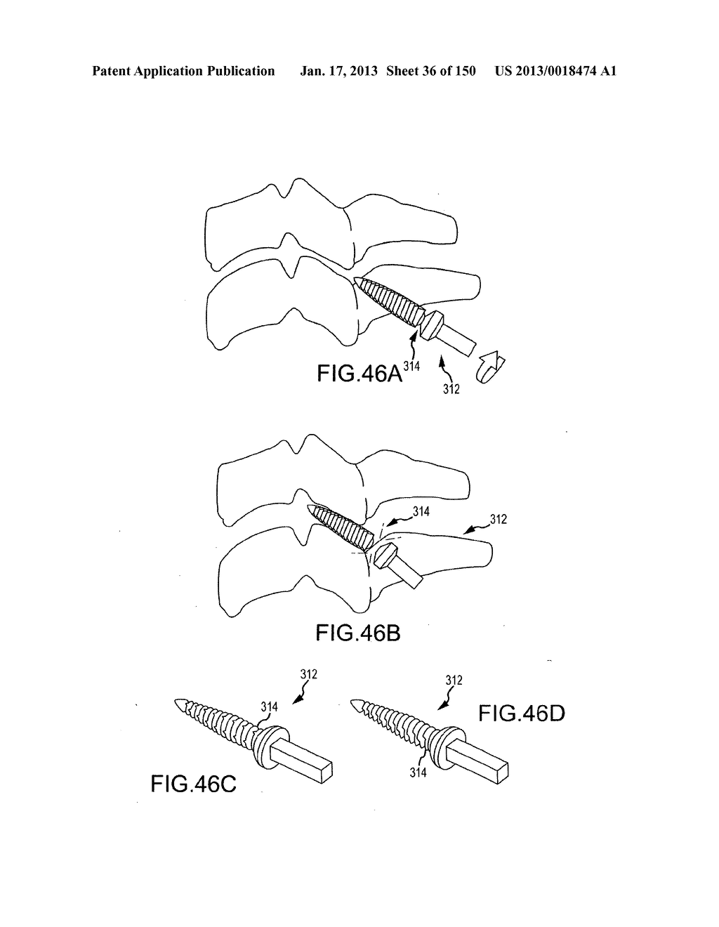 VERTEBRAL JOINT IMPLANTS AND DELIVERY TOOLS - diagram, schematic, and image 37