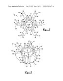 SHOULDER PROSTHESIS diagram and image