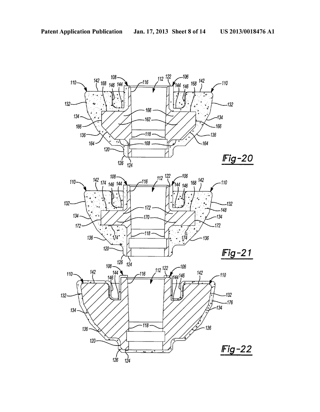 SHOULDER PROSTHESIS - diagram, schematic, and image 09