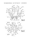 SHOULDER PROSTHESIS diagram and image