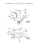 SHOULDER PROSTHESIS diagram and image