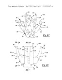 SHOULDER PROSTHESIS diagram and image