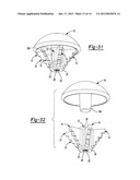 SHOULDER PROSTHESIS diagram and image