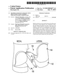 Methods and Devices for Knee Joint Replacement with Anterior Cruciate     Ligament Substitution diagram and image