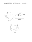 Methods and Devices for Knee Joint Replacement with Anterior Cruciate     Ligament Substitution diagram and image