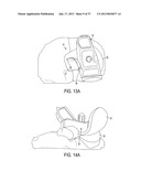 Methods and Devices for Knee Joint Replacement with Anterior Cruciate     Ligament Substitution diagram and image