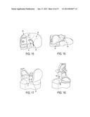 Methods and Devices for Knee Joint Replacement with Anterior Cruciate     Ligament Substitution diagram and image