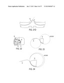 Methods and Devices for Knee Joint Replacement with Anterior Cruciate     Ligament Substitution diagram and image