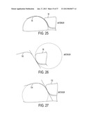 Methods and Devices for Knee Joint Replacement with Anterior Cruciate     Ligament Substitution diagram and image