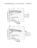 Methods and Devices for Knee Joint Replacement with Anterior Cruciate     Ligament Substitution diagram and image