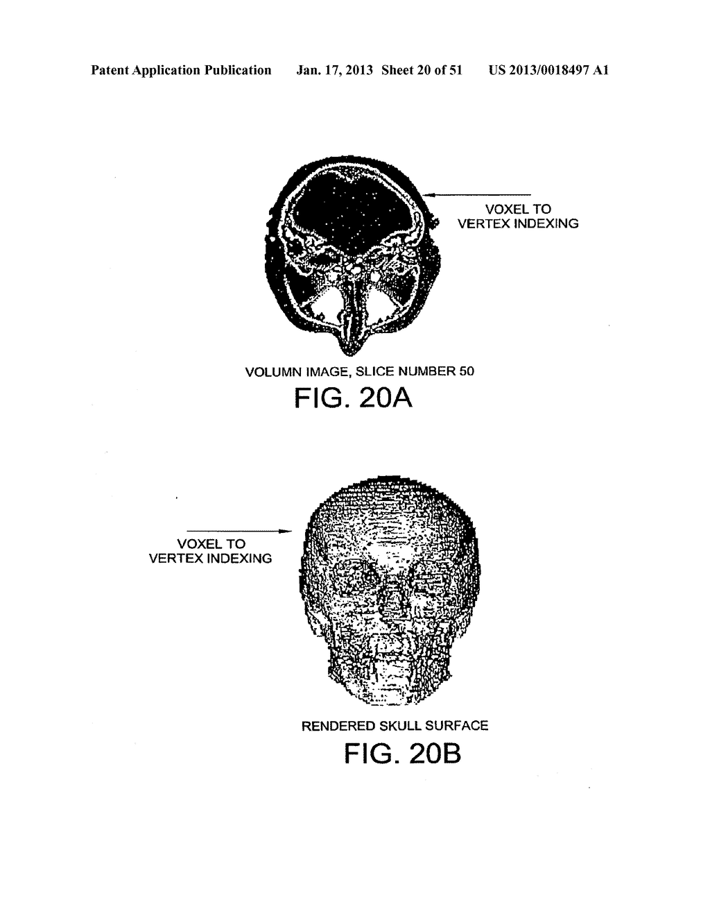 METHODS AND SYSTEMS FOR PRODUCING AN IMPLANT - diagram, schematic, and image 21