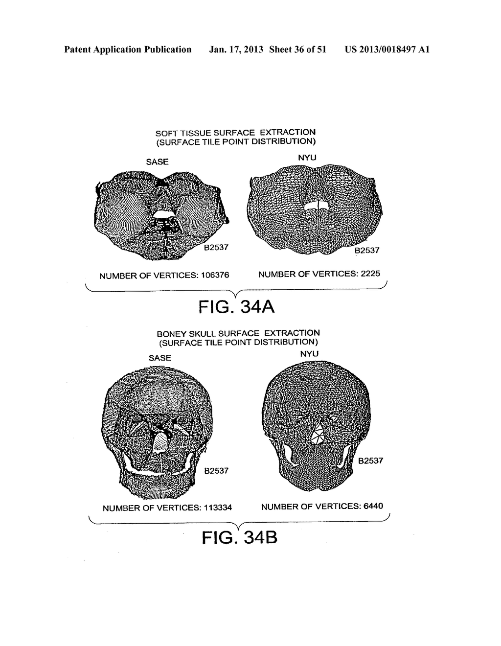 METHODS AND SYSTEMS FOR PRODUCING AN IMPLANT - diagram, schematic, and image 37