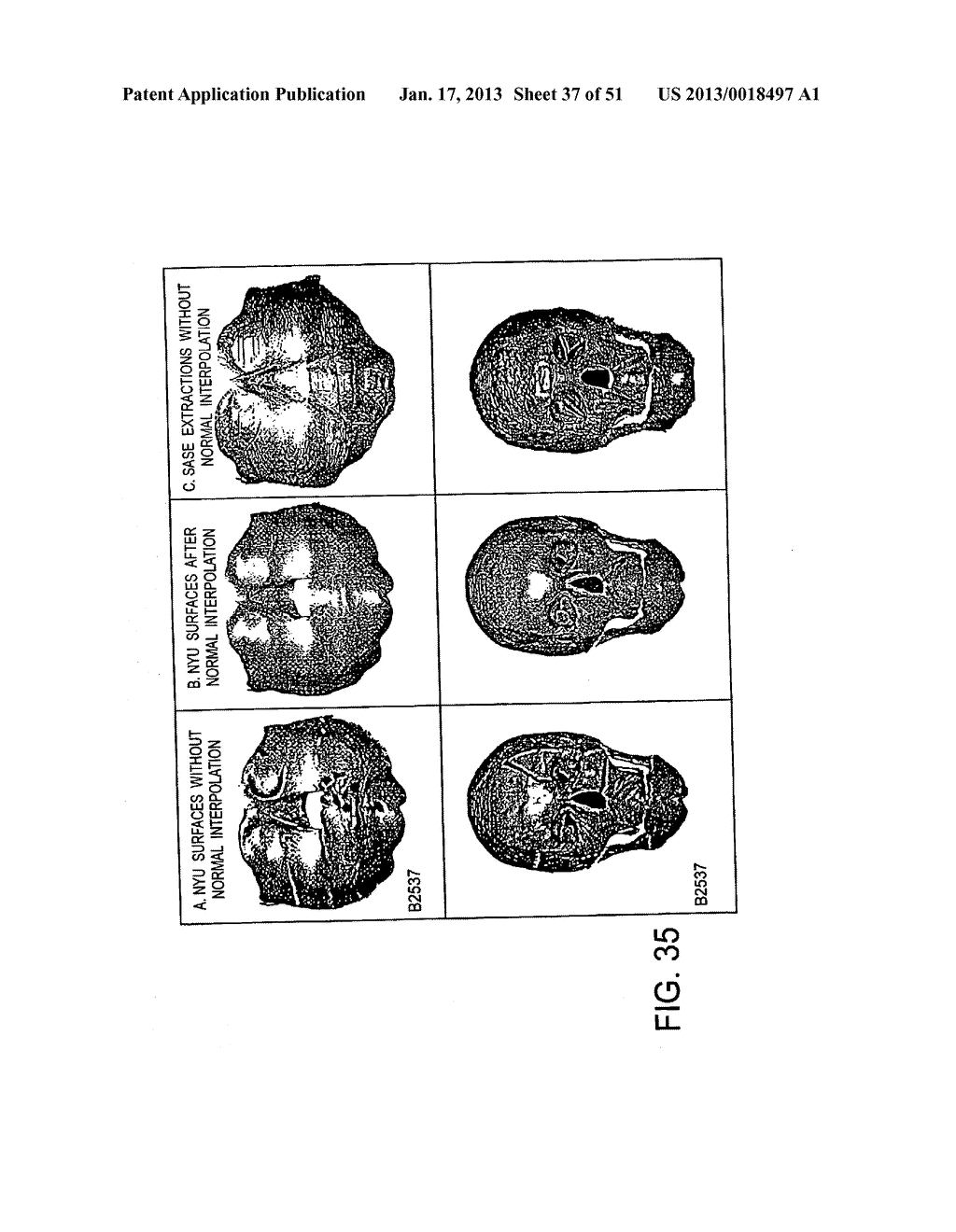 METHODS AND SYSTEMS FOR PRODUCING AN IMPLANT - diagram, schematic, and image 38