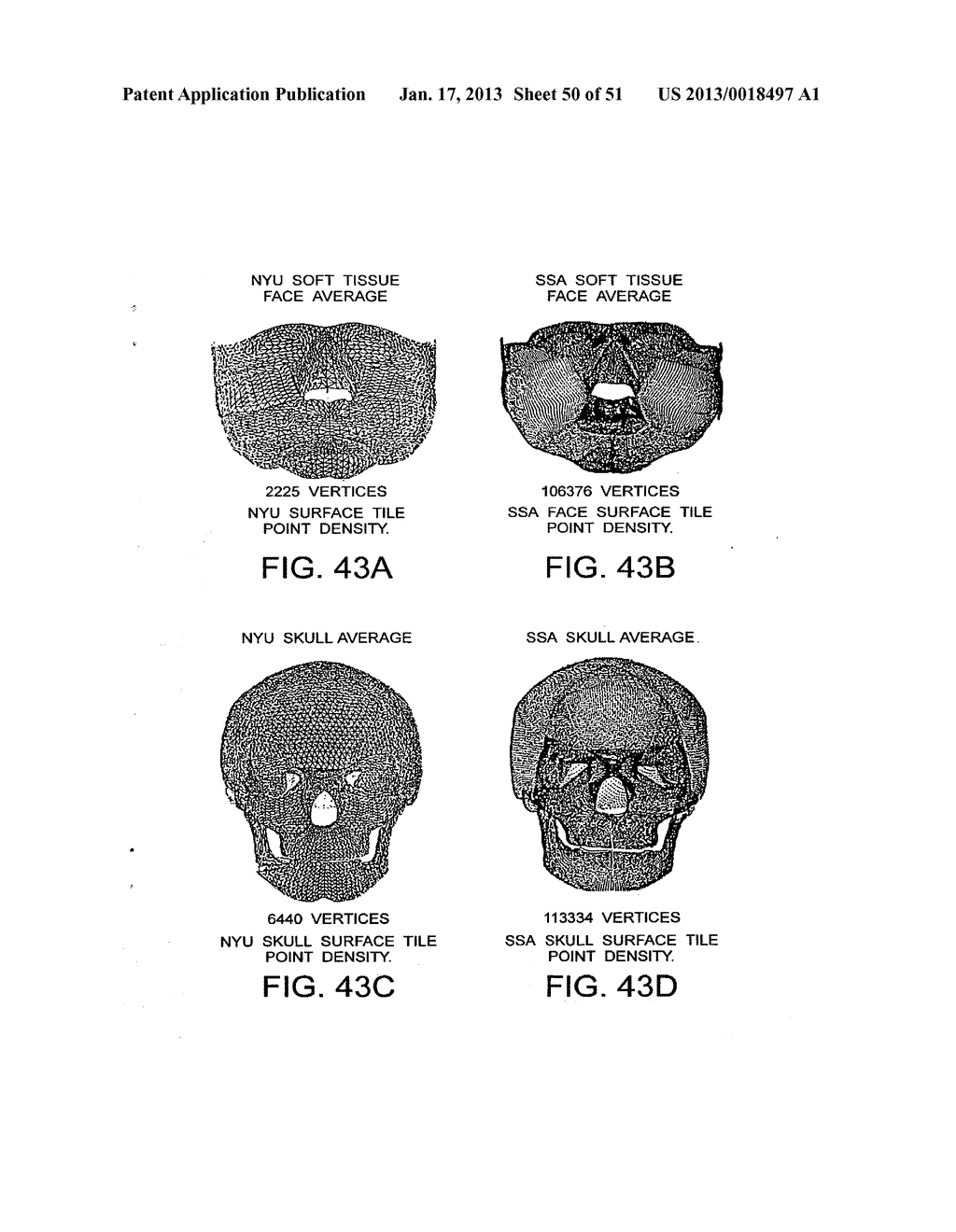 METHODS AND SYSTEMS FOR PRODUCING AN IMPLANT - diagram, schematic, and image 51