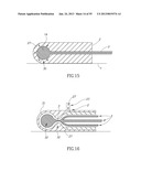 GEL-BASED SEALS AND FIXATION DEVICES AND ASSOCIATED SYSTEMS AND METHODS diagram and image