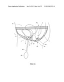 GEL-BASED SEALS AND FIXATION DEVICES AND ASSOCIATED SYSTEMS AND METHODS diagram and image