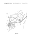 GEL-BASED SEALS AND FIXATION DEVICES AND ASSOCIATED SYSTEMS AND METHODS diagram and image