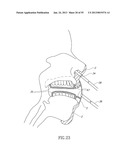 GEL-BASED SEALS AND FIXATION DEVICES AND ASSOCIATED SYSTEMS AND METHODS diagram and image