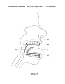 GEL-BASED SEALS AND FIXATION DEVICES AND ASSOCIATED SYSTEMS AND METHODS diagram and image